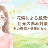 花粉による肌荒れ、目元の赤み対策。その原因と効果的なケアを解説。