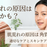 肌荒れの原因は角質かも？適切なケアとスキンケアで美肌へ