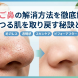 いちご鼻の解消方法を徹底解説。つるつる肌を取り戻す秘訣とは？