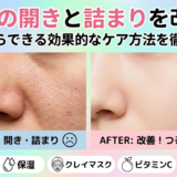 毛穴の開きと詰まりを改善!今日からできる効果的なケア方法を徹底解説。